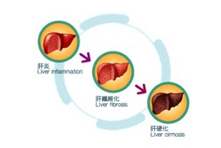专家介绍如何正确诊断早泄