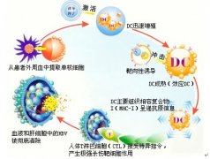 什么是DC细胞以及DC细胞治疗原理？